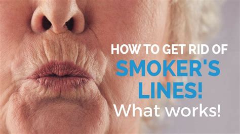 Can you reverse wrinkles from nicotine?