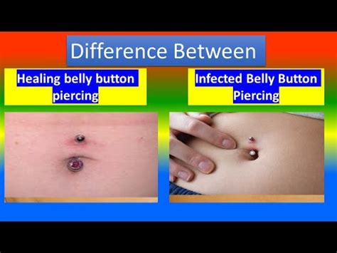 Can you save an infected piercing?