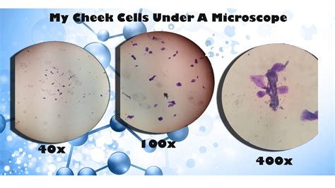 Can you see bacteria at 40x?