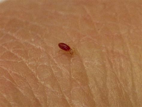 Can you see bed bugs with the naked eye?