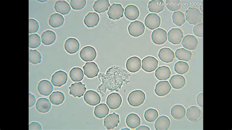 Can you see cells with a 1000x microscope?