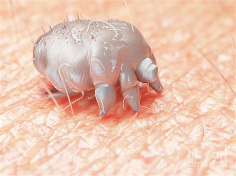 Can you see human itch mites?