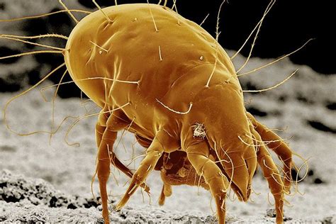 Can you see mites on you?