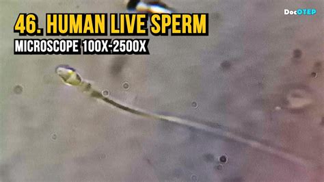 Can you see sperm at 100x?