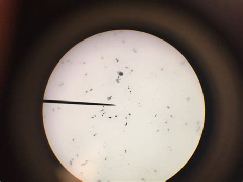 Can you see sperm at 40x magnification?