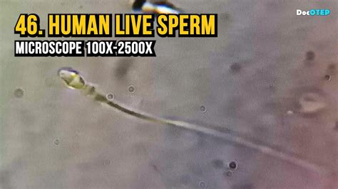 Can you see sperm at 600x?