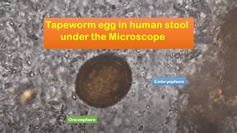 Can you see tapeworm eggs in human stool?