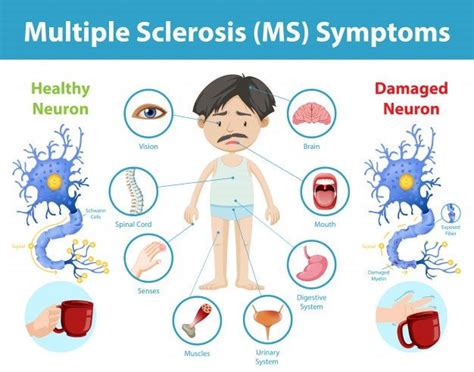 Can you stop my multiple sclerosis?