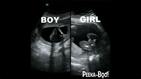 Can you tell if it is a boy or girl at 12 weeks?
