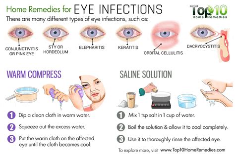 Can you treat bacterial eye infection at home?