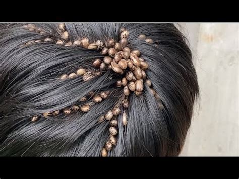 Can you wash ticks out of your hair?