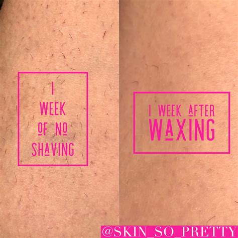 Can you wax again after 1 week?