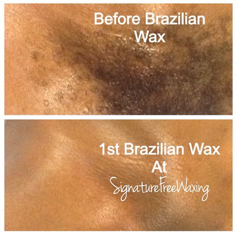 Can you wet after Brazilian wax?
