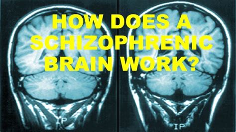 Can your brain heal from schizophrenia?