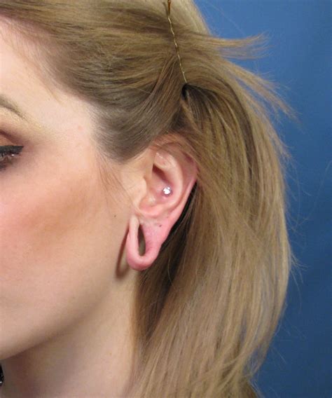 Can your ears reject gauges?