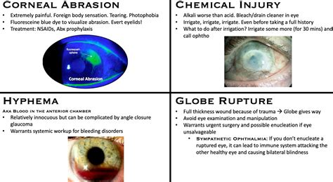 Can your eyes change due to trauma?