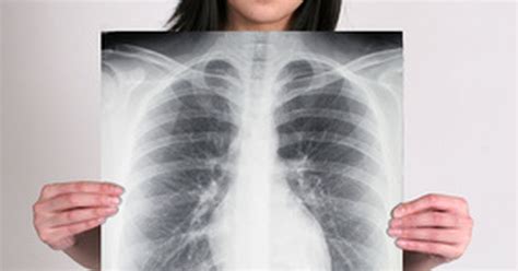 Can your lungs get scarred?