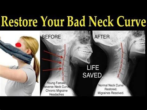 Can your neck change shape?