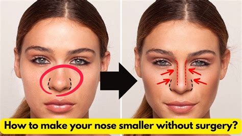 Can your nose get smaller?