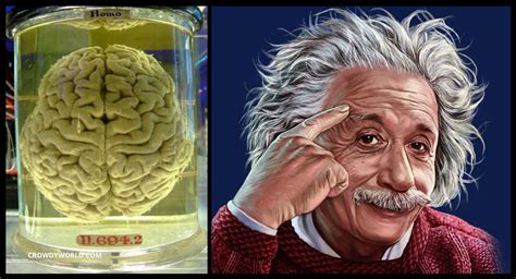 Did Einstein have a big brain?