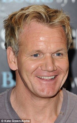 Did Gordon Ramsay get new teeth?