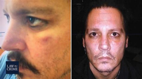 Did Johnny Depp suffer from trauma?