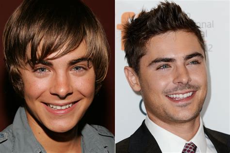 Did Zac Efron get his teeth done?