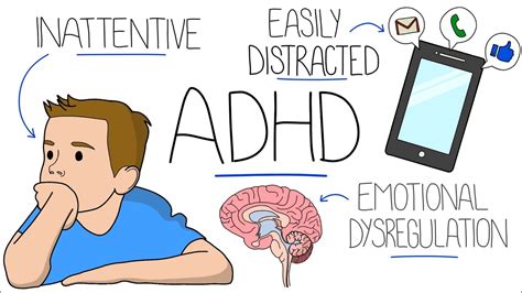 Do ADHD people like certain music?