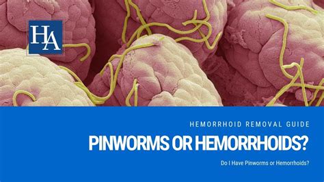 Do I have pinworms or hemorrhoids?