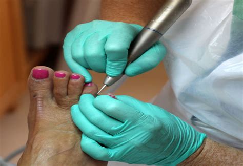 Do Pedicurists judge your feet?