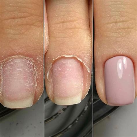 Do Russian manicures help nails grow?