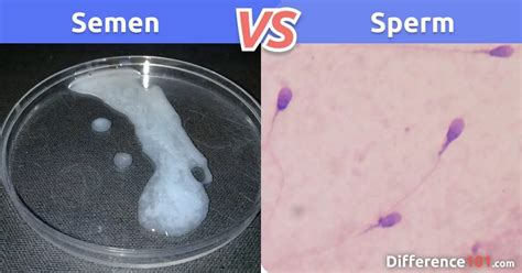 Do STDs affect sperm?