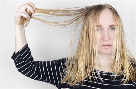 Do Scandinavians lose their hair?