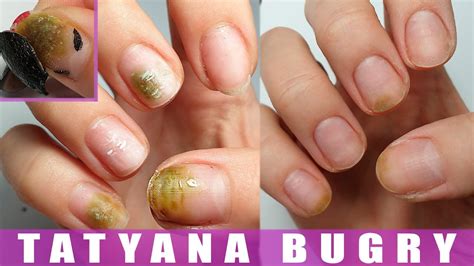 Do acrylic nails hold bacteria?