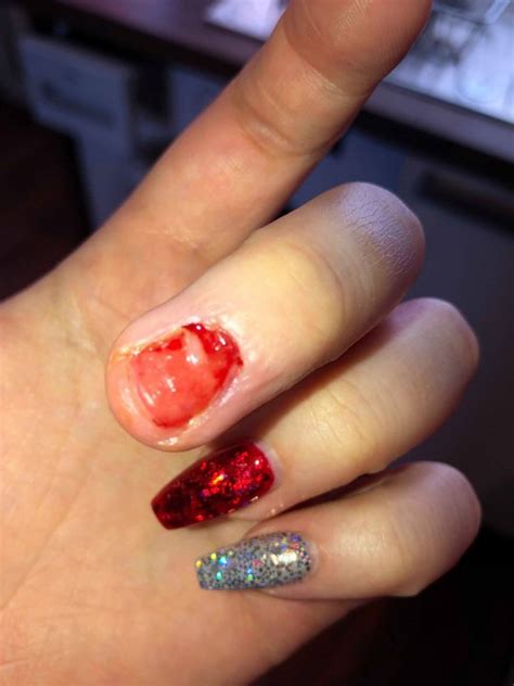 Do acrylic nails hurt your real nails?
