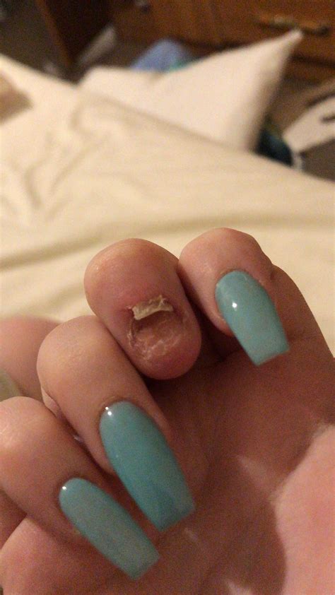 Do acrylics fall off naturally?