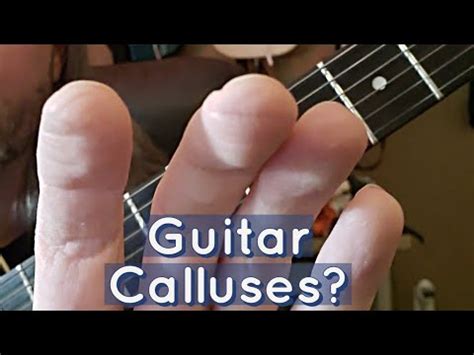Do all guitarists have calluses?