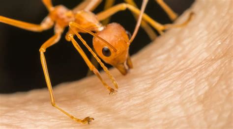 Do ants feel pain burnt?