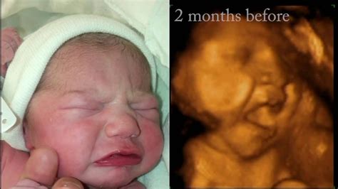 Do babies cry in the womb?