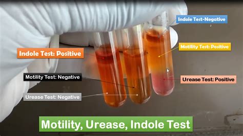 Do bacteria use indole?