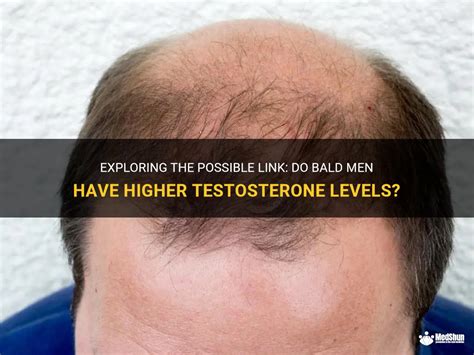 Do bald men have higher testosterone?