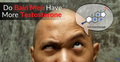 Do bald men have more testosterone?