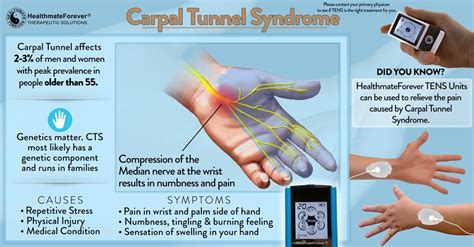 Do bananas help carpal tunnel?