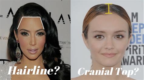 Do bangs affect your hairline?