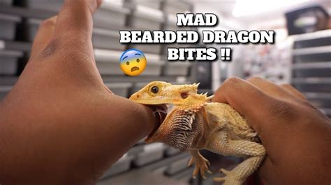 Do bearded dragon bites hurt?