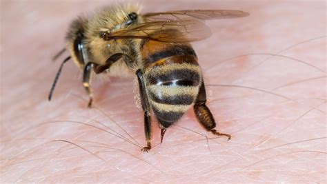Do bees leave their stinger in you?