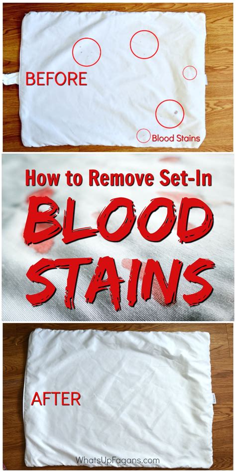 Do blood stains go away?