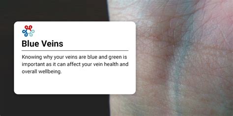 Do blue veins mean lack of oxygen?