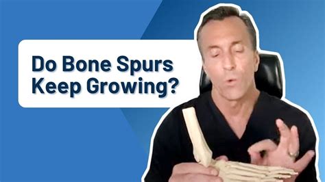Do bone spurs keep growing?