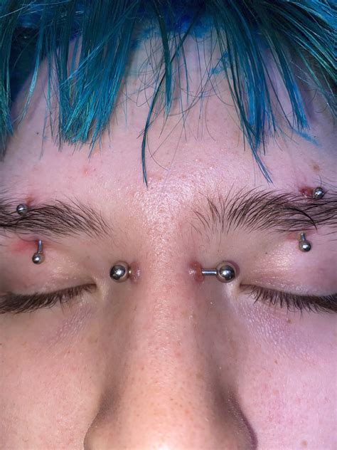 Do bridge piercings always reject?